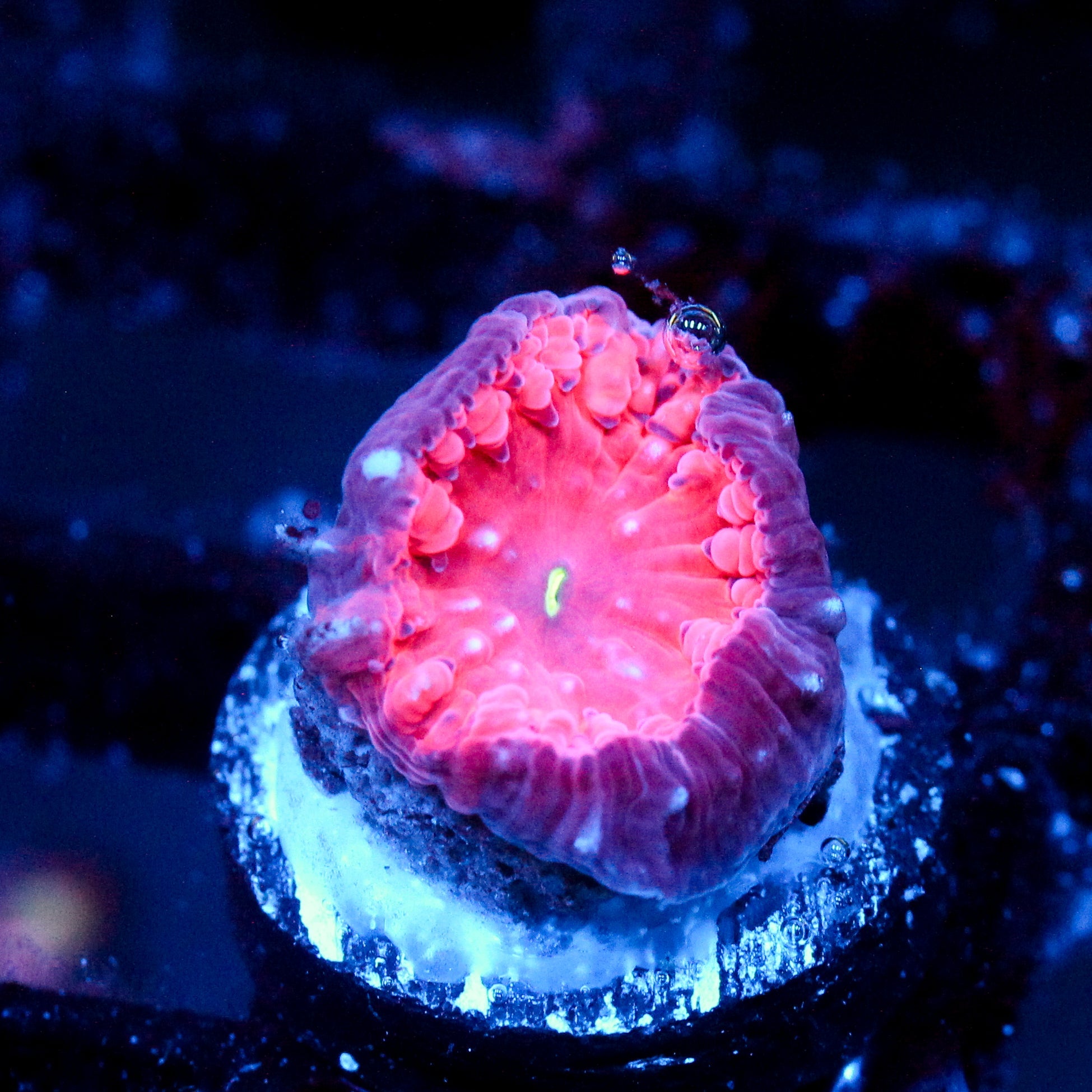 JC Hemoglobin Blasto