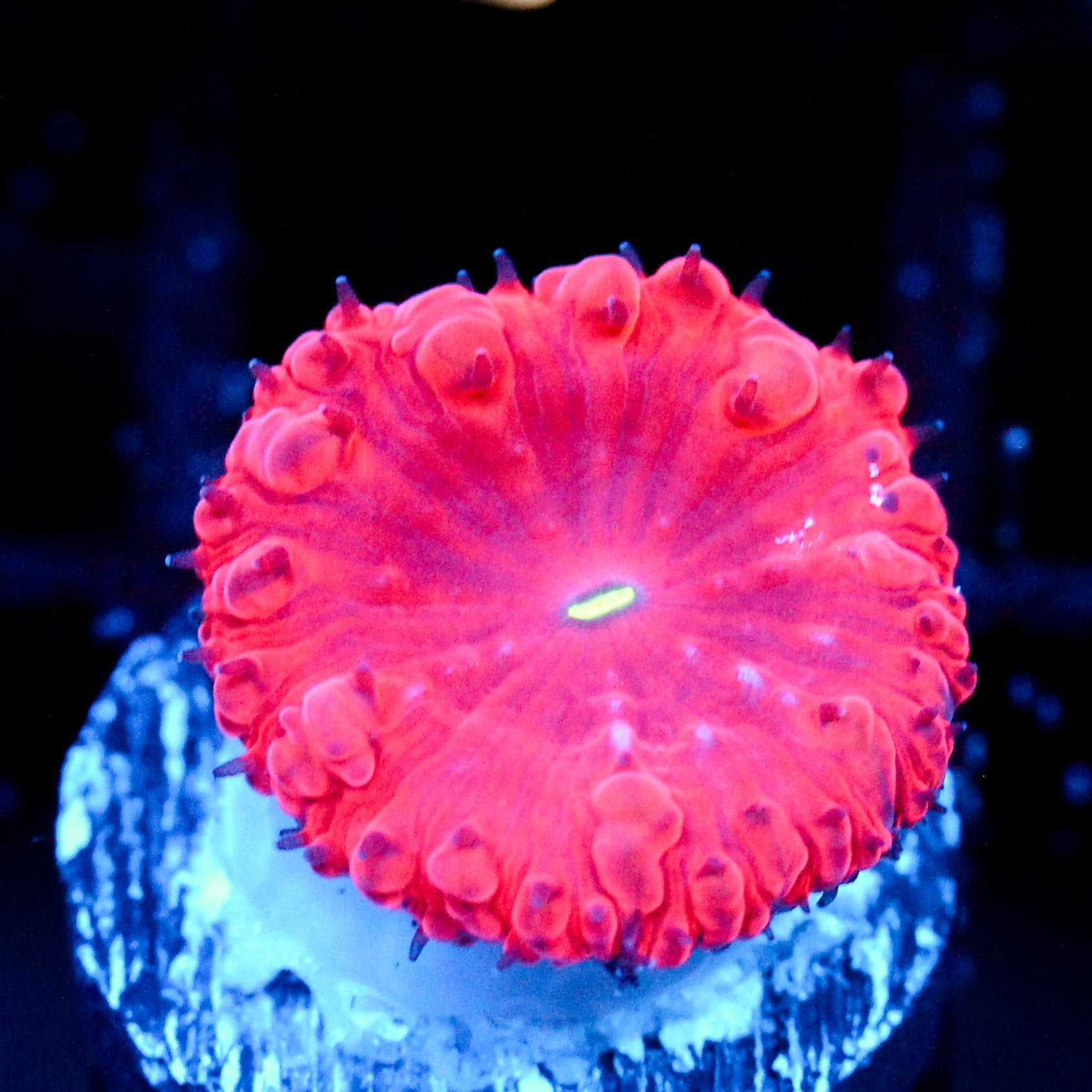 JC Hemoglobin Blasto