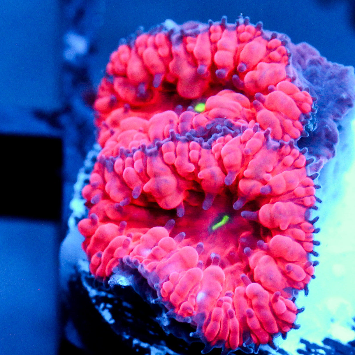 JC Hemoglobin Blasto