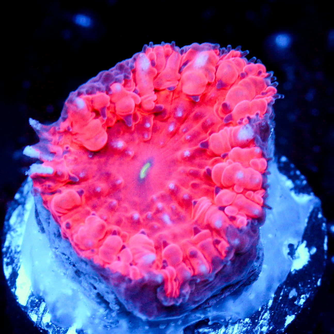 JC Hemoglobin Blasto
