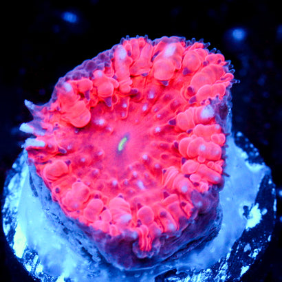 JC Hemoglobin Blasto