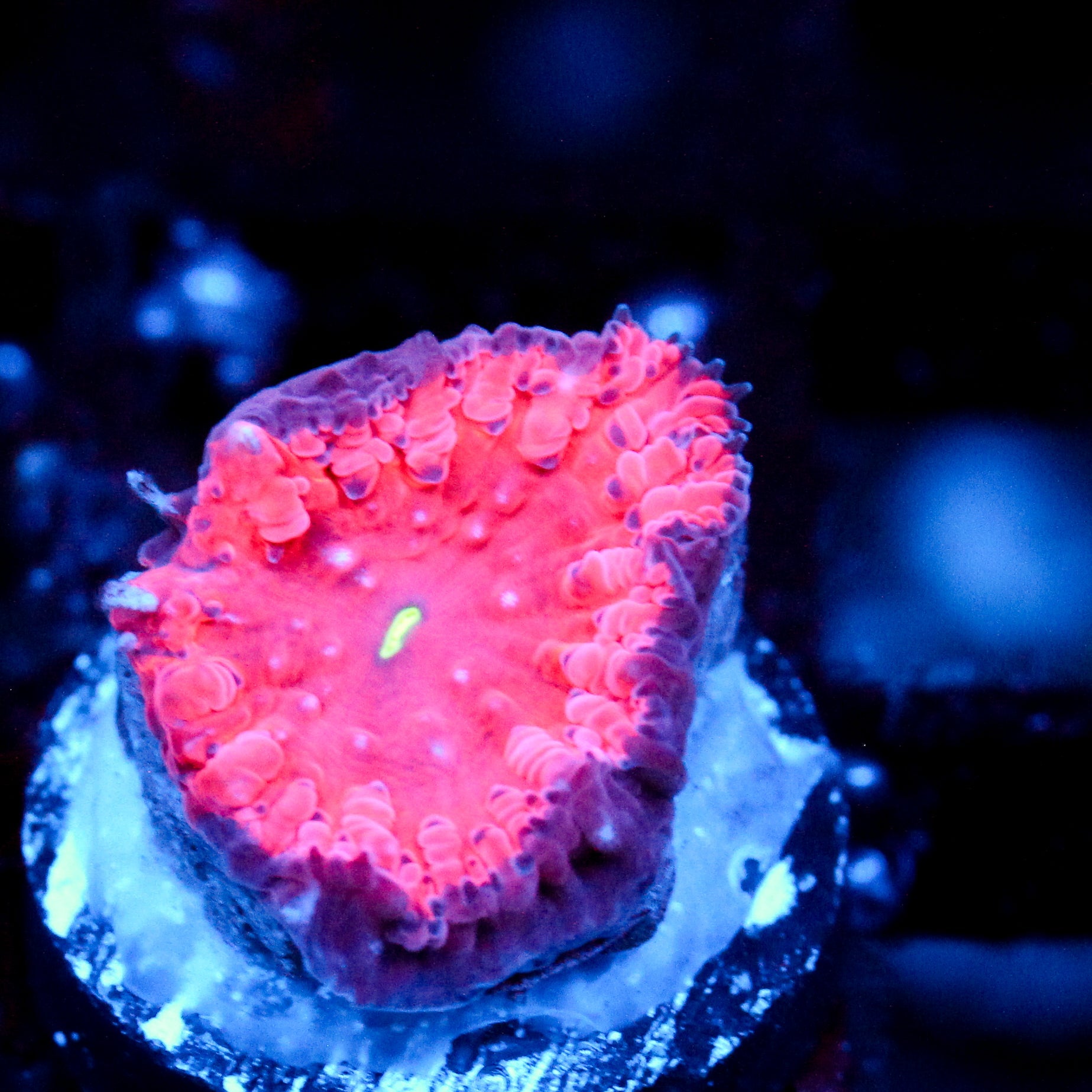 JC Hemoglobin Blasto